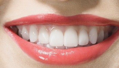 Эстетика передних зубов