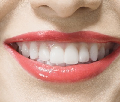 Эстетика передних зубов