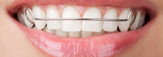 Ортодонтия: здоровые зубы и красивая улыбка