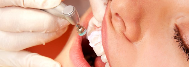 Ультразвуковая чистка зубов - максимально безопасно