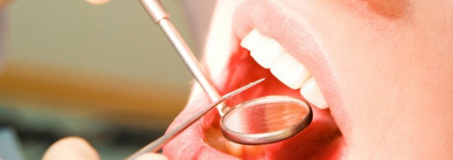 Самые основные признаки кариеса зубов