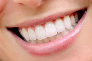 Коррекция зубов и все методики